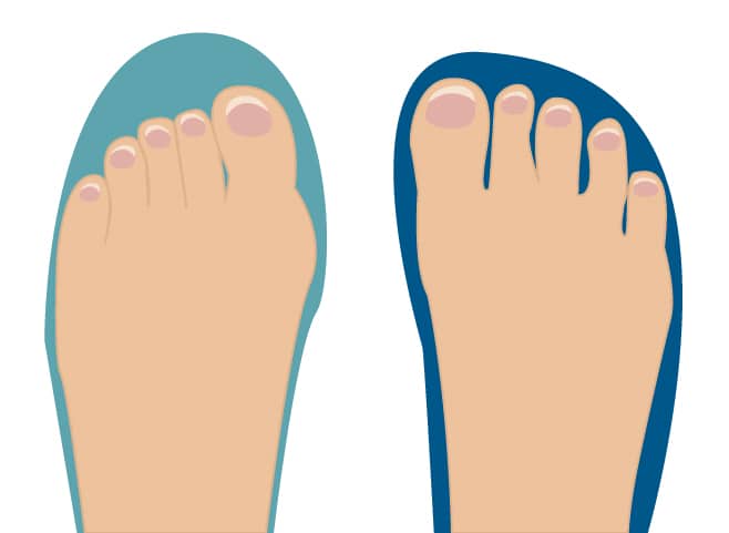 Toebox-02