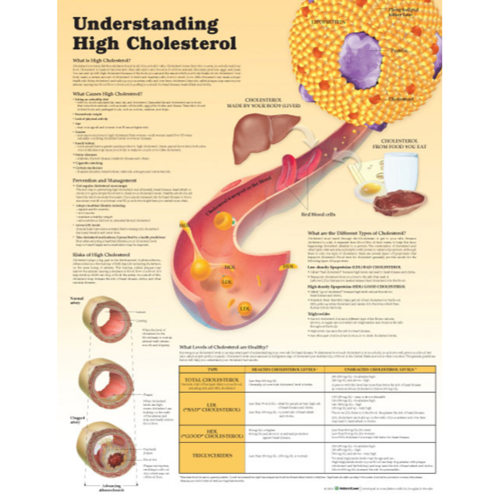 Understanding High Cholesterol Paper  None  Paper